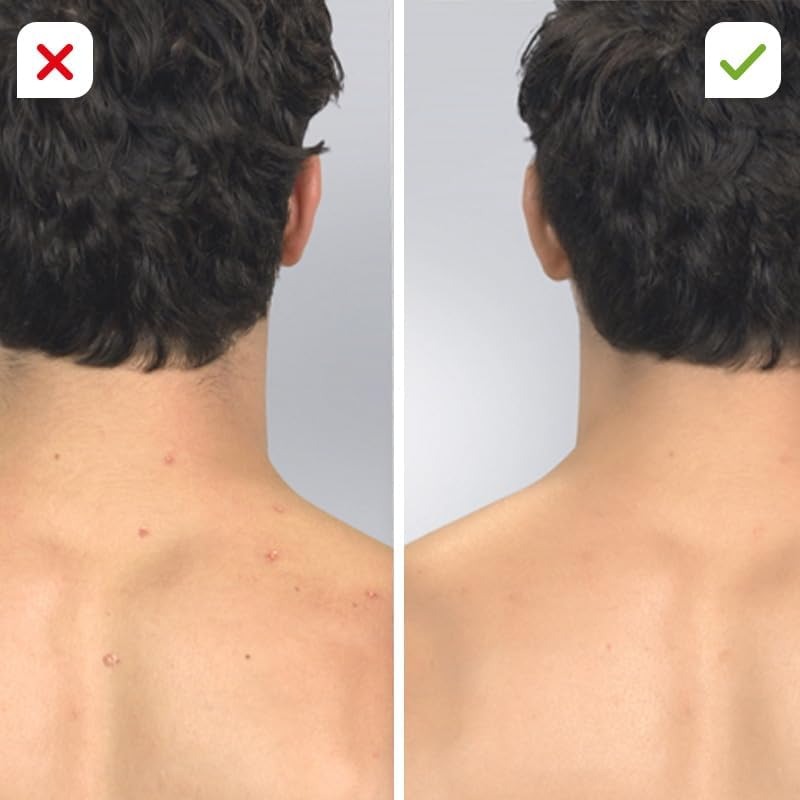 Pore Cleaning Device