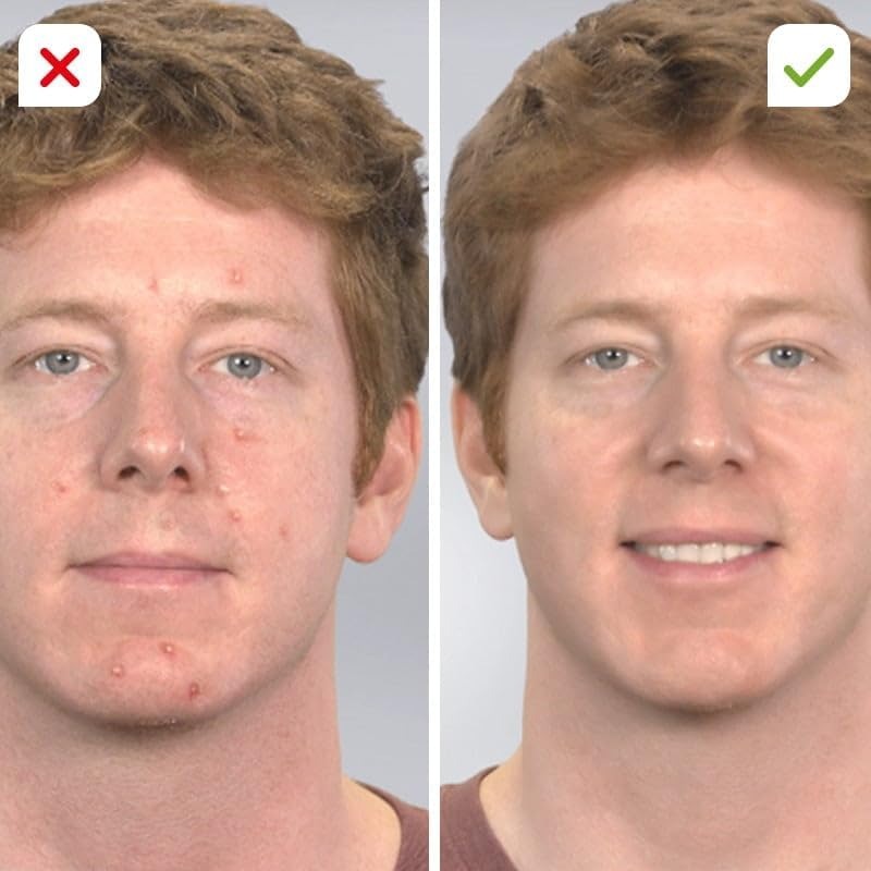 Pore Cleaning Device