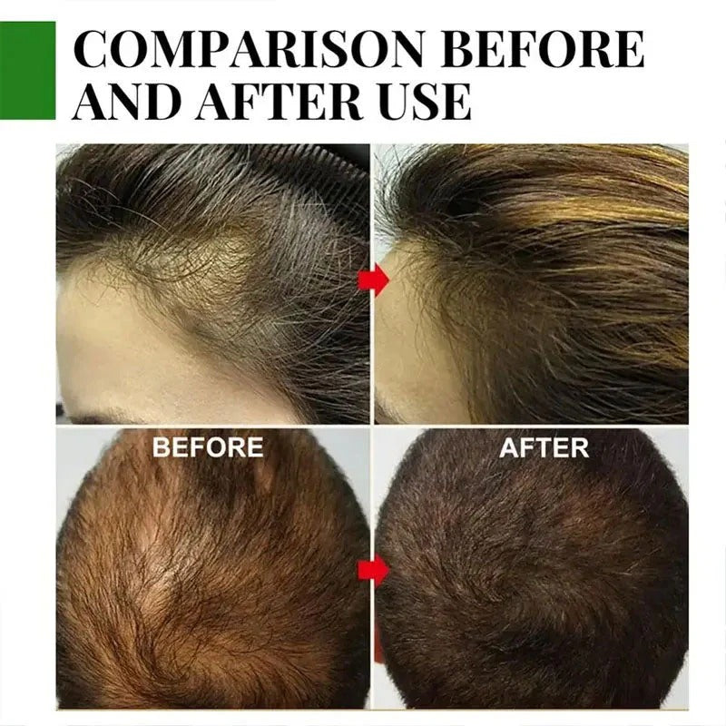 Rosemary Hair Care Essential Oil