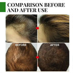 Rosemary Hair Care Essential Oil